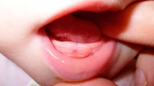 Когда появляются зубки у ребенка. Режутся первые зубки